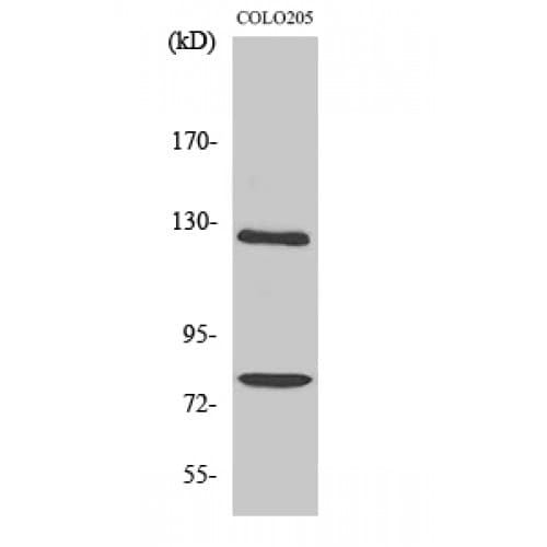 Polyclonal Rabbit anti-Human COL1A2 / Collagen I Alpha 2 Antibody (440-520 aa, Internal, IHC, IF, WB)