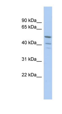 TRIM50 / E3 Ubiquitin Ligase Antibody (aa251-300)