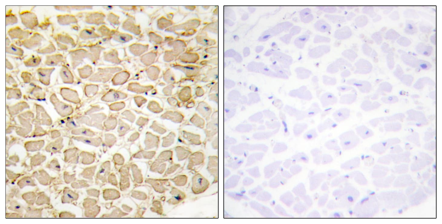 CDH13 / Cadherin 13 Antibody (aa331-380)