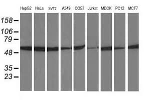 TUBB4 / Tubulin Beta 4 Antibody (clone 3C12, Carrier-free)
