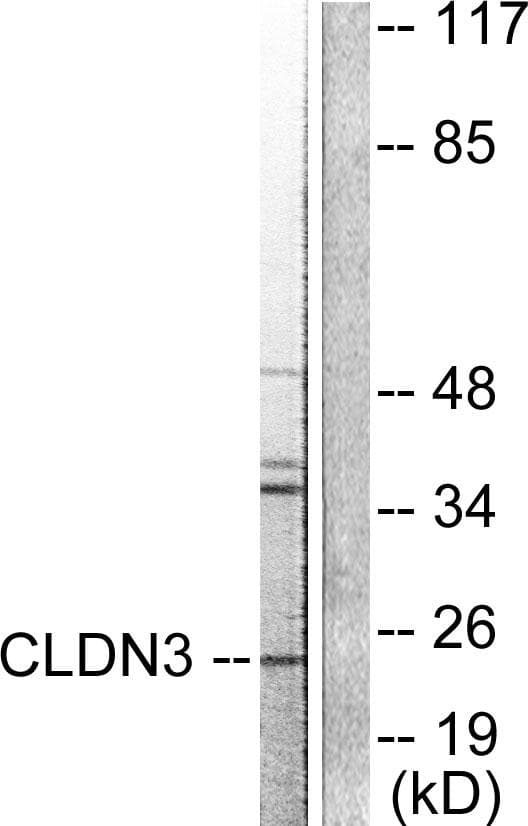 CLDN3 / Claudin 3 Antibody