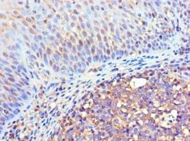 Polyclonal Rabbit anti-Human FLOT2 / Flotillin 2 Antibody (aa239-428, IHC, WB)