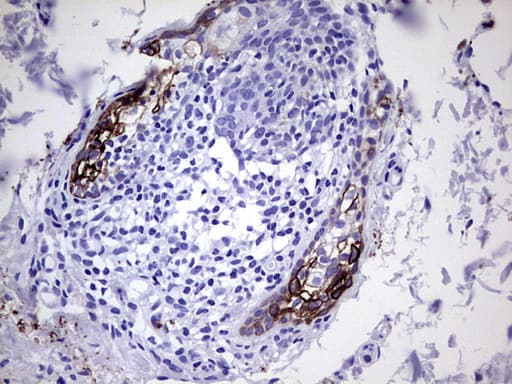 KRT7 / CK7 / Cytokeratin 7 Antibody (aa1-114, clone UMAB161)