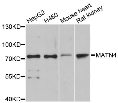 MATN4 / Matrilin 4 Antibody