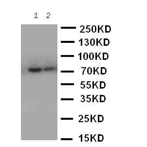 PMP70 Antibody (aa646-659)