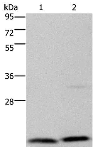 MCTS1 Antibody