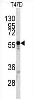 A1BG Antibody (aa421-449)