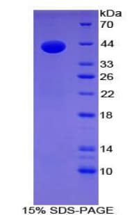 Mouse Gastrin Protein (Recombinant His-GST)