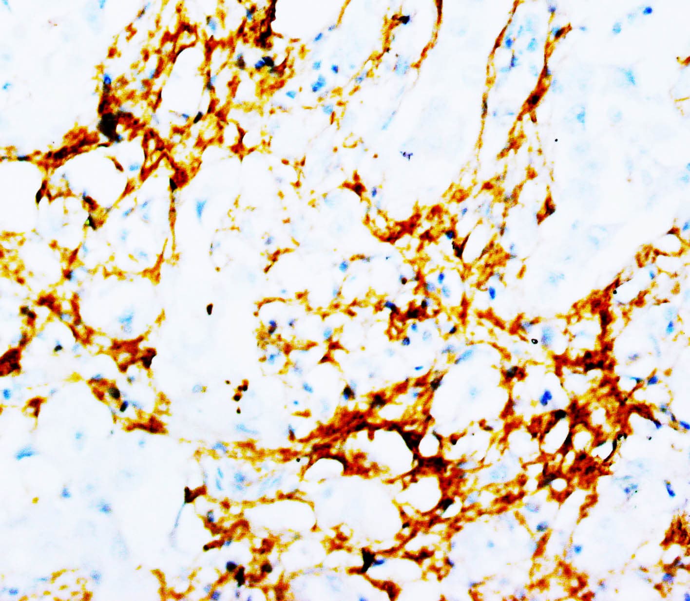 TNN / Tenascin N Antibody (clone T20)