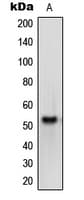 OPN4 / Melanopsin Antibody (C-Terminus)
