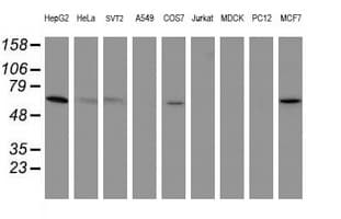 PGM3 Antibody (clone OTI1A11)