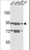 IHC-plus™ Polyclonal Rabbit anti-Human ABCB5 Antibody (aa1-30, IHC, WB)