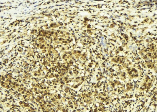 SUPT4H1 / SPT4 Antibody