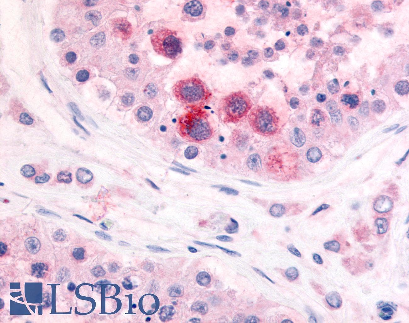 IHC-plus™ PDE3A Antibody (N-Terminus)