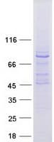 Human MTO1 Protein (Recombinant Myc-DDK (Flag))