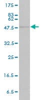 IHC-plus™ Monoclonal Mouse anti-Human STAT4 Antibody (clone 1C2-1C12, IHC, IF, WB)