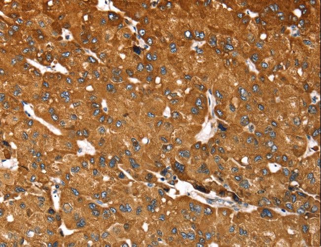 RASSF3 Antibody