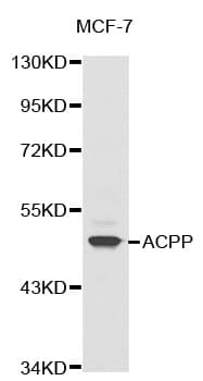 Polyclonal Rabbit anti-Human ACPP / PAP Antibody (IHC, WB)