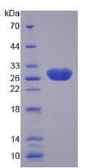 Human LAMA4 / Laminin Alpha 4 Protein (Recombinant His)