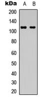 Polyclonal Rabbit anti-Human PRKD1 / PKC Mu Antibody (C-Terminus, IHC, WB)