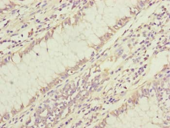 DYNC1I1 Antibody