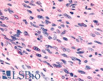 PathPlus™ Polyclonal Rabbit anti-Human FFAR1 / GPR40 Antibody (Cytoplasmic Domain, IHC, WB)