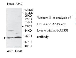 AP3S1 Antibody (aa2-193)