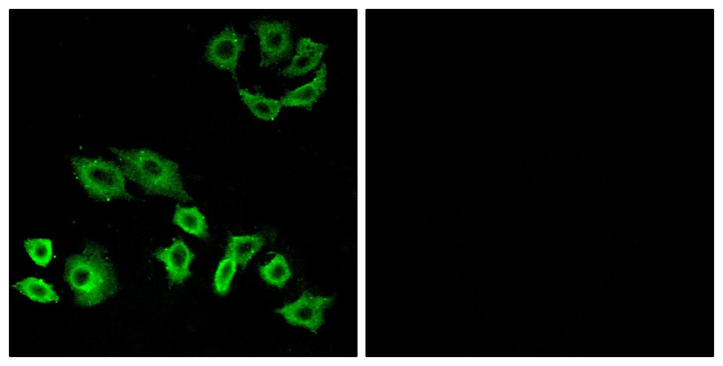 Polyclonal Rabbit anti-Human TTF / RHOH Antibody (IF, WB)