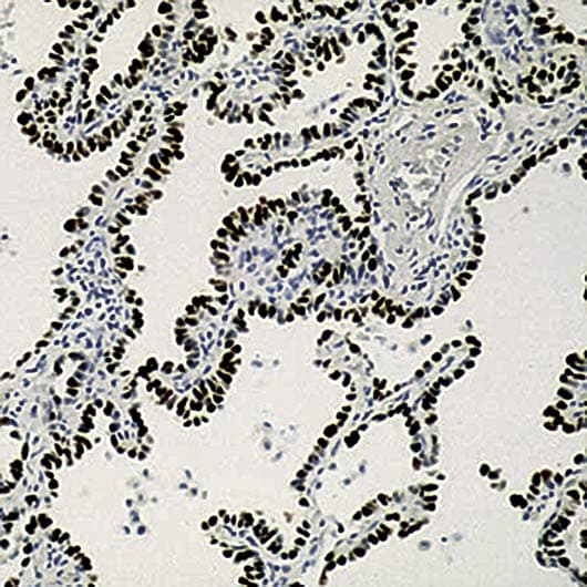 NKX2-1 / Thyroid-Specific TF Antibody (clone 8G7G3/1)