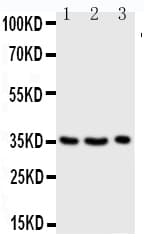 GZMA / Granzyme A Antibody (aa175-190)