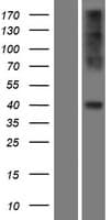 Human CCR2 Protein (Over-Expression Lysate Myc-DDK (Flag))