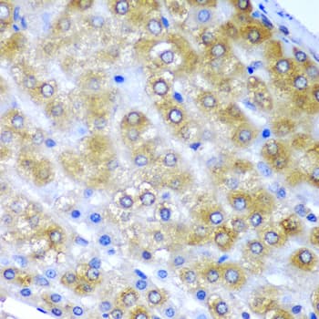 Polyclonal Rabbit anti-Human BMF Antibody (IHC, WB)
