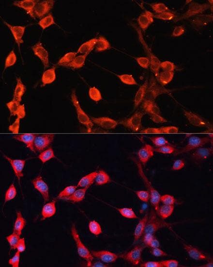 ADAMTS13 Antibody