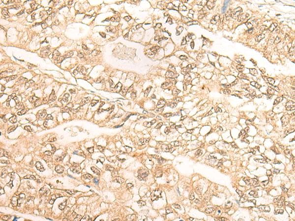 Polyclonal Rabbit anti-Human DMC1 Antibody (IHC)