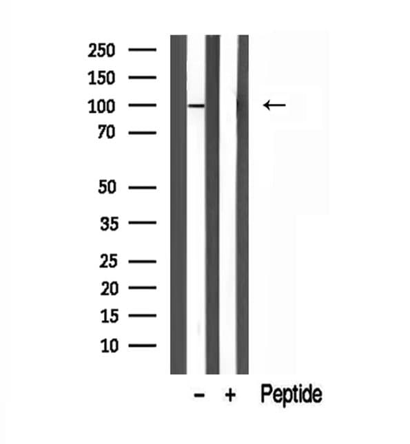 Polyclonal Rabbit anti-Human VG5Q / AGGF1 Antibody (IHC, WB)