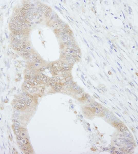 EIF4EBP1 / 4EBP1 Antibody (aa75-C-term)