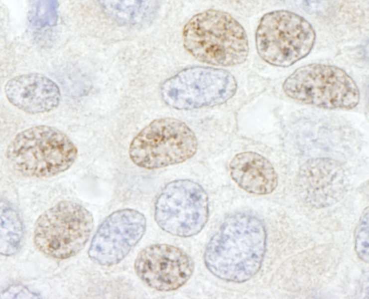 DDX46 Antibody (aa981-C-term)