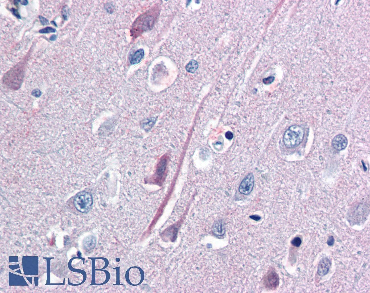 IHC-plus™ NTRK2 / TRKB Antibody (aa1-429)