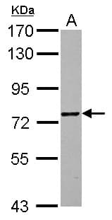 ZNF418 Antibody (Internal)