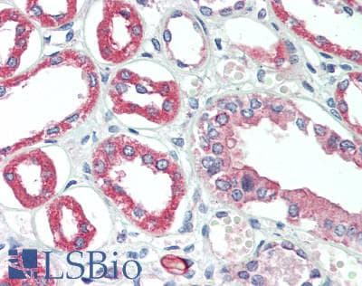 IHC-plus™ Polyclonal Rabbit anti-Human KCNJ1 / ROMK Antibody (IHC, WB)