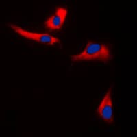 EPS8L3 Antibody (Internal)