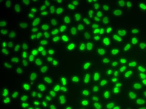 HDGF Antibody