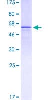 Human STC2 / Stanniocalcin 2 Protein (Recombinant GST)