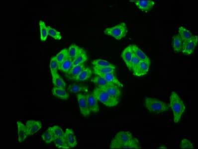 Polyclonal Rabbit anti-Human SCN11A / Nav1.9 Antibody (IHC, IF)