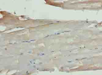 Polyclonal Rabbit anti-Human KCNK13 / THIK-1 Antibody (IHC, WB)