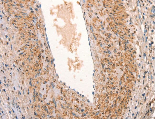 ARFRP1 Antibody