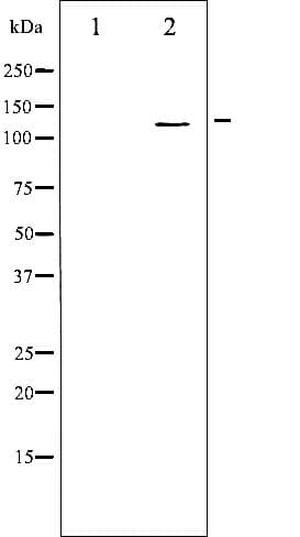 Polyclonal Rabbit anti-Human ITGB3 / Integrin Beta 3 / CD61 Antibody (phospho-Tyr773, IHC, IF, WB)