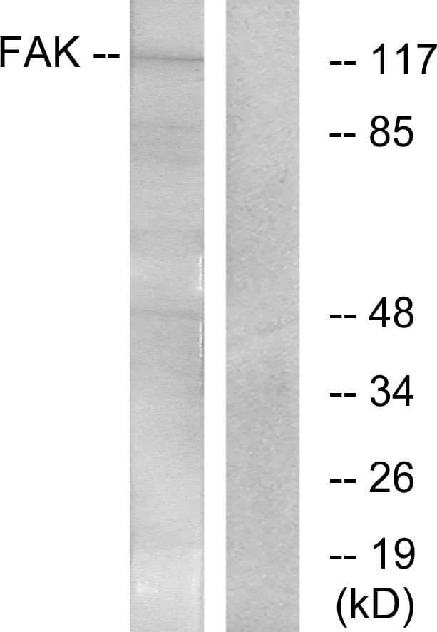 Polyclonal Rabbit anti-Human FAK / Focal Adhesion Kinase Antibody (aa364-413, WB)