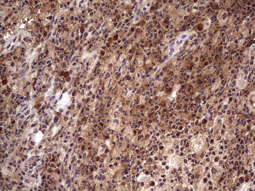 BFSP2 Antibody (aa184-415, clone OTI4E7, Carrier-free)