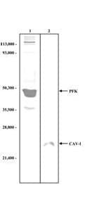 PFKM / PFK-1 Antibody (Liquid)